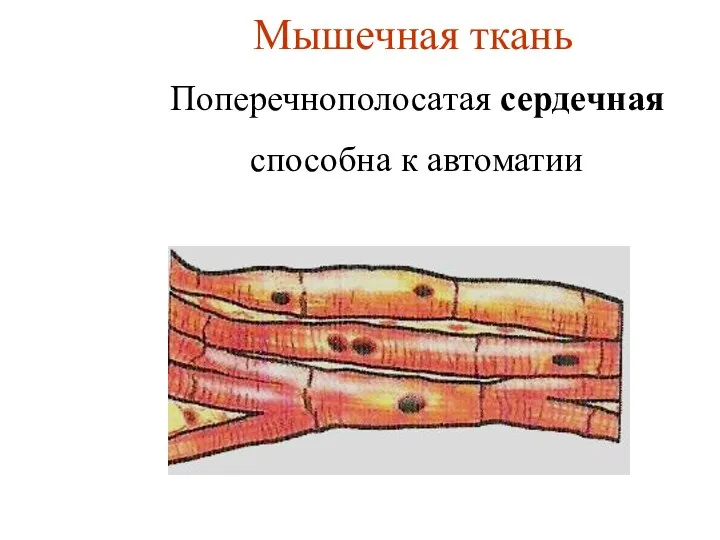 Мышечная ткань Поперечнополосатая сердечная способна к автоматии