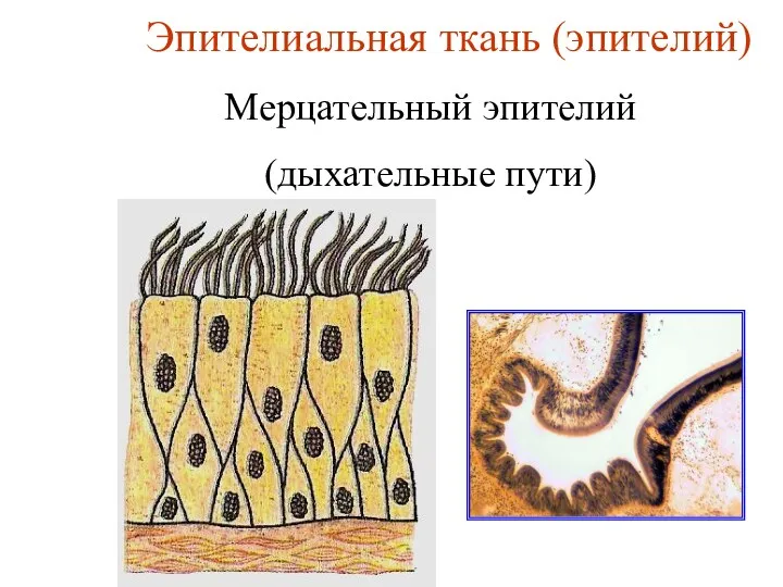 Эпителиальная ткань (эпителий) Мерцательный эпителий (дыхательные пути)