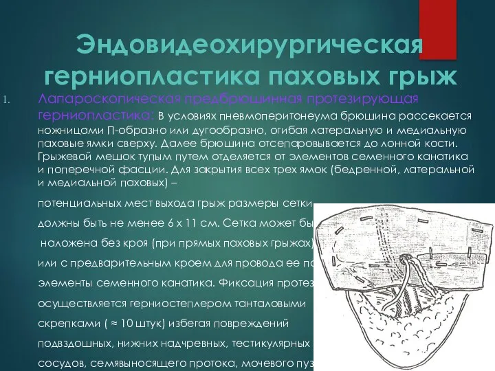 Эндовидеохирургическая герниопластика паховых грыж Лапароскопическая предбрюшинная протезирующая герниопластика: В условиях пневмоперитонеума брюшина рассекается