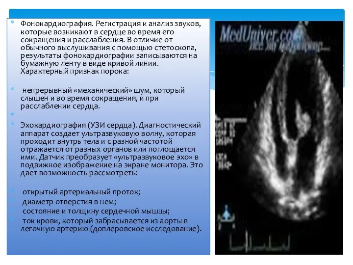 Фонокардиография. Регистрация и анализ звуков, которые возникают в сердце во