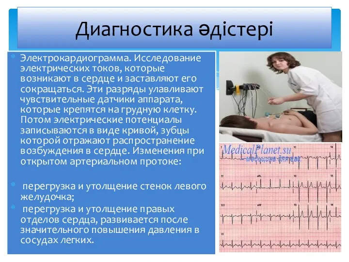 Электрокардиограмма. Исследование электрических токов, которые возникают в сердце и заставляют