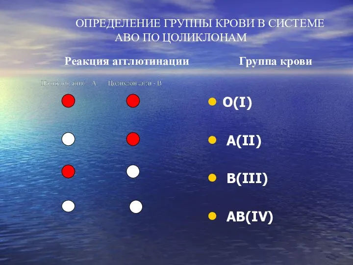 ОПРЕДЕЛЕНИЕ ГРУППЫ КРОВИ В СИСТЕМЕ АВО ПО ЦОЛИКЛОНАМ Реакция агглютинации Группа крови О(I) A(II) B(III) AB(IV)