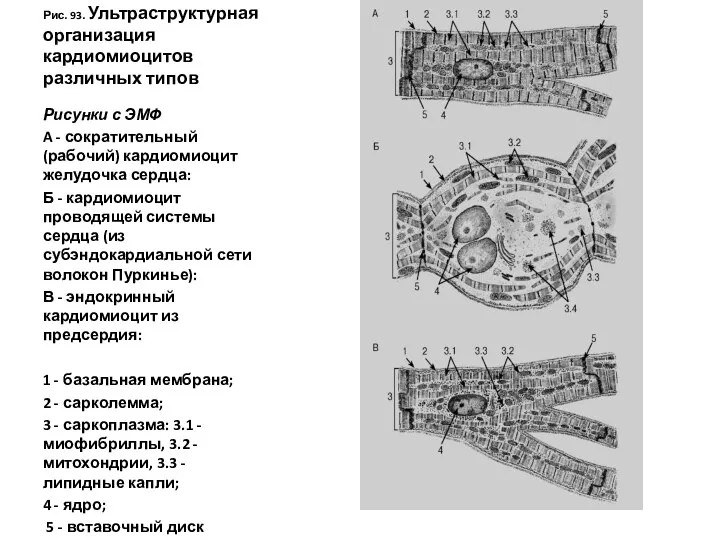 Рис. 93. Ультраструктурная организация кардиомиоцитов различных типов Рисунки с ЭМФ