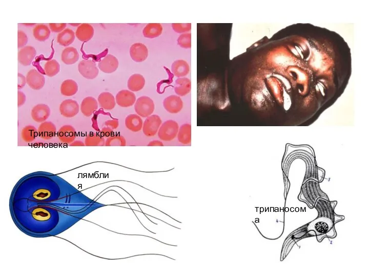 Трипаносомы в крови человека трипаносома лямблия