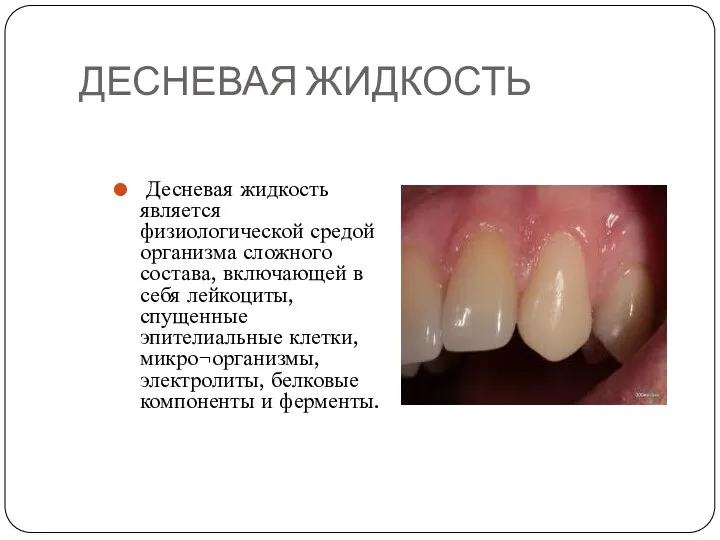 ДЕСНЕВАЯ ЖИДКОСТЬ Десневая жидкость является физиологической средой организма сложного состава,