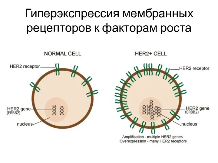 Гиперэкспрессия мембранных рецепторов к факторам роста