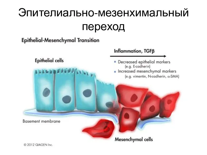 Эпителиально-мезенхимальный переход