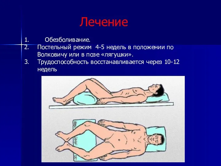 Лечение Обезболивание. Постельный режим 4-5 недель в положении по Волковичу