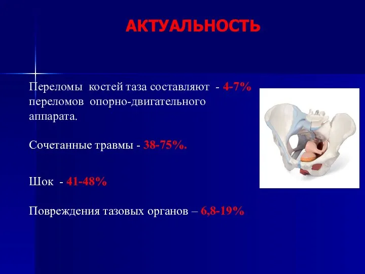 АКТУАЛЬНОСТЬ Переломы костей таза составляют - 4-7% переломов опорно-двигательного аппарата.