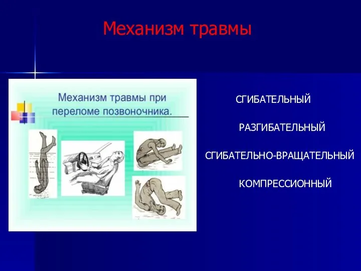 Механизм травмы СГИБАТЕЛЬНЫЙ РАЗГИБАТЕЛЬНЫЙ Г СГИБАТЕЛЬНО-ВРАЩАТЕЛЬНЫЙ КОМПРЕССИОННЫЙ