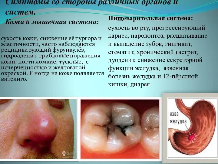 Симптомы со стороны различных органов и систем. Кожа и мышечная