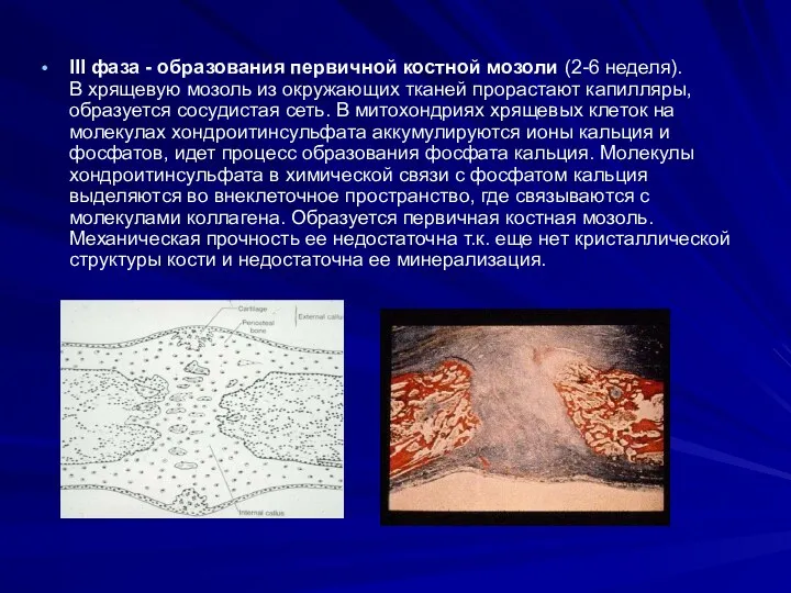 III фаза - образования первичной костной мозоли (2-6 неделя). В хрящевую мозоль из