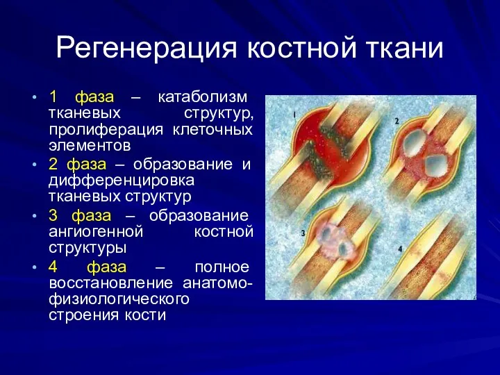 Регенерация костной ткани 1 фаза – катаболизм тканевых структур, пролиферация