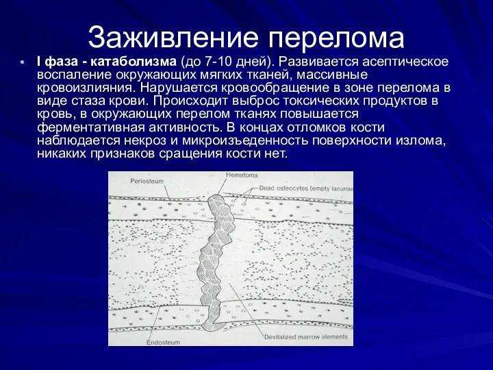 Заживление перелома I фаза - катаболизма (до 7-10 дней). Развивается асептическое воспаление окружающих