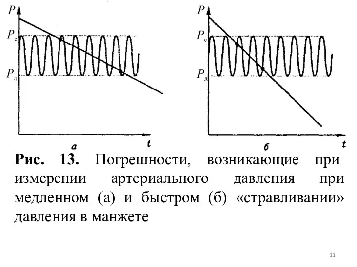 Рис. 13. Погрешности, возникающие при измерении артериального давления при медленном