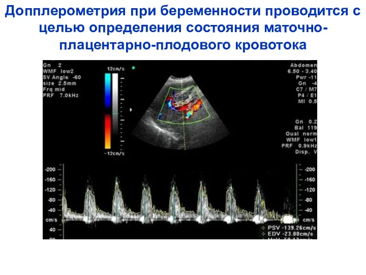 Допплерометрия при беременности проводится с целью определения состояния маточно-плацентарно-плодового кровотока