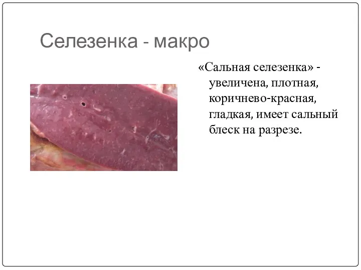 Селезенка - макро «Сальная селезенка» - увеличена, плотная, коричнево-красная, гладкая, имеет сальный блеск на разрезе.