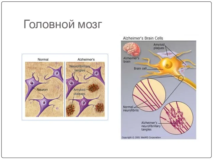 Головной мозг