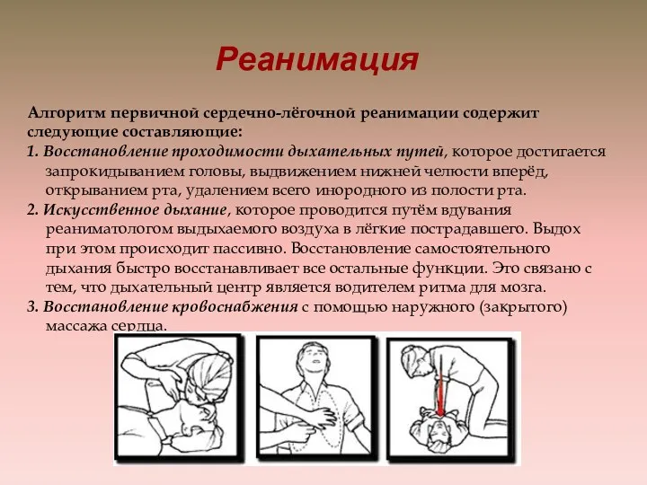 Реанимация Алгоритм первичной сердечно-лёгочной реанимации содержит следующие составляющие: 1. Восстановление