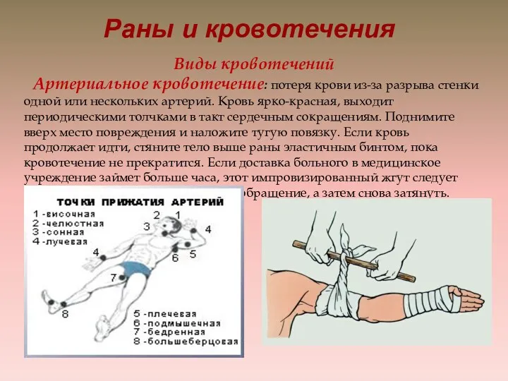 Раны и кровотечения Виды кровотечений Артериальное кровотечение: потеря крови из-за