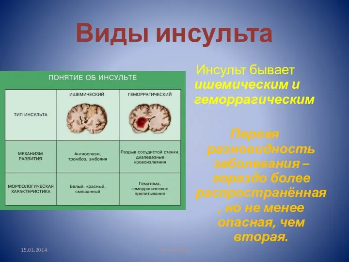 Виды инсульта Инсульт бывает ишемическим и геморрагическим Первая разновидность заболевания