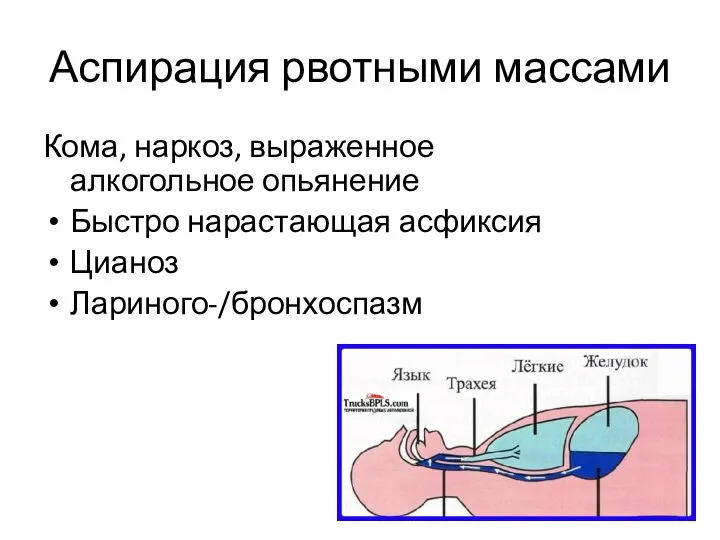 Аспирация рвотными массами Кома, наркоз, выраженное алкогольное опьянение Быстро нарастающая асфиксия Цианоз Лариного-/бронхоспазм