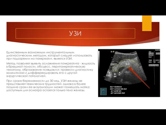 УЗИ Единственным возможным инструментальным диагностическим методом, который следует использовать при подозрении на панкреатит,