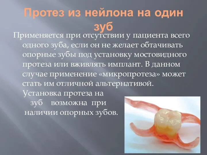 Протез из нейлона на один зуб Применяется при отсутствии у