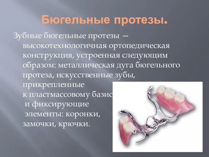 Бюгельные протезы. Зубные бюгельные протезы — высокотехнологичная ортопедическая конструкция, устроенная