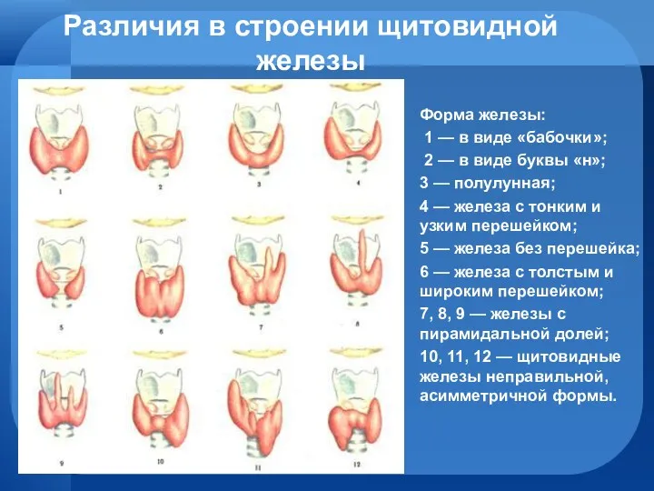 Различия в строении щитовидной железы Форма железы: 1 — в