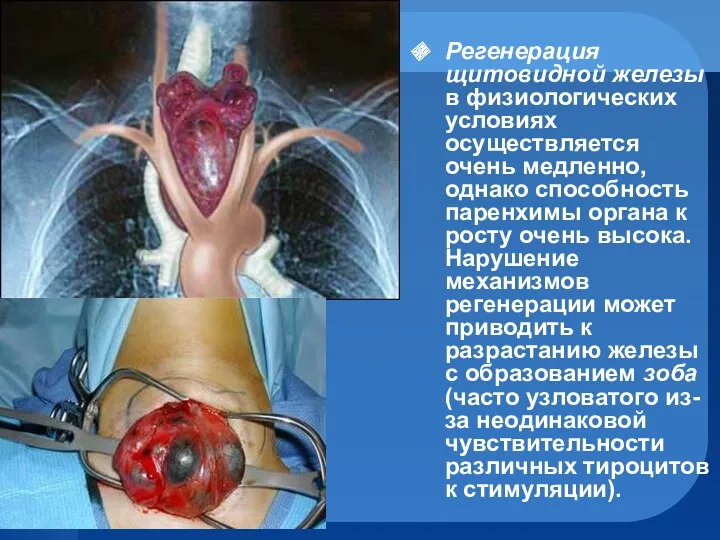 Регенерация щитовидной железы в физиологических условиях осуществляется очень медленно, однако