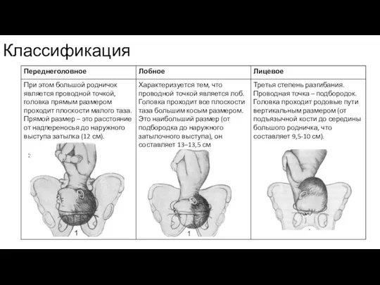 Классификация