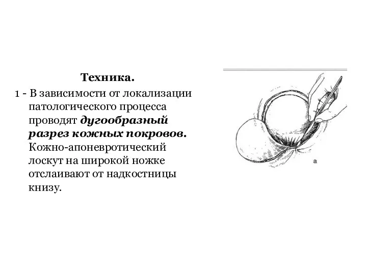 Техника. 1 - В зависимости от локализации патологического процесса проводят