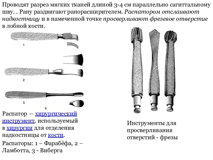 Проводят разрез мягких тканей длиной 3-4 см параллельно сагиттальному шву.