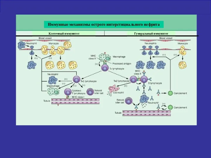 Иммунные механизмы острого интерстициального нефрита Клеточный иммунитет Гуморальный иммунитет