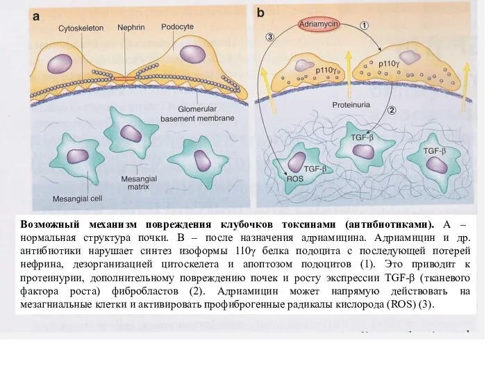 Возможный механизм повреждения клубочков токсинами (антибиотиками). А – нормальная структура