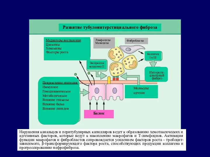 Развитие тубулоинтерстициального фиброза Медиаторы воспаления: Циокины Хемокины Факторы роста Лимфоциты