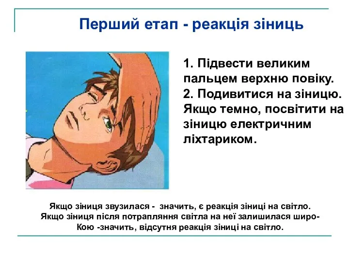 1. Підвести великим пальцем верхню повіку. 2. Подивитися на зіницю. Якщо темно, посвітити