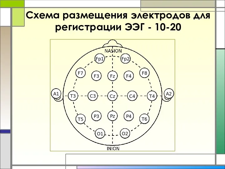 Схема размещения электродов для регистрации ЭЭГ - 10-20