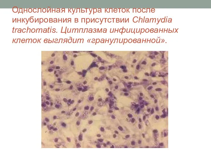 Однослойная культура клеток после инкубирования в присутствии Chlamydia trachomatis. Цитплазма инфицированных клеток выглядит «гранулированной».