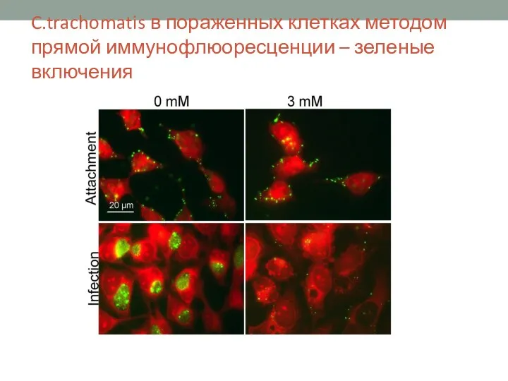 C.trachomatis в пораженных клетках методом прямой иммунофлюоресценции – зеленые включения