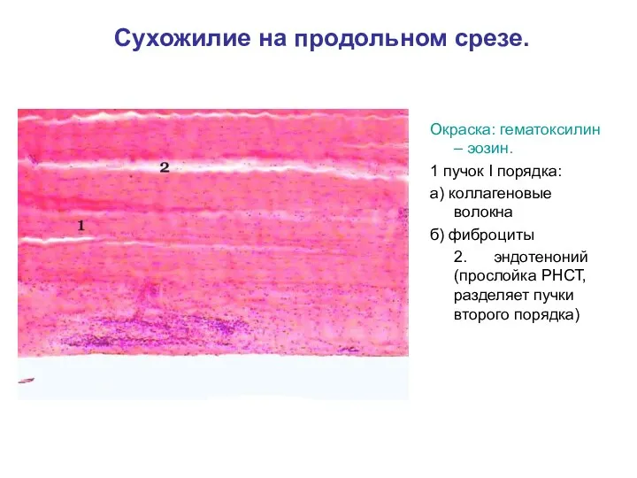 Сухожилие на продольном срезе. Окраска: гематоксилин – эозин. 1 пучок