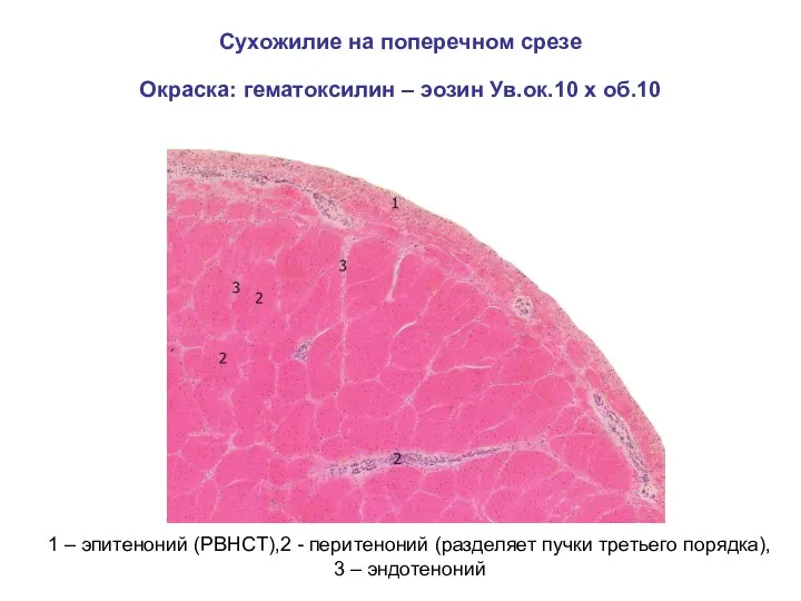 Сухожилие на поперечном срезе Окраска: гематоксилин – эозин Ув.ок.10 х