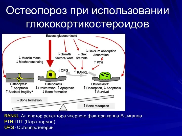 Остеопороз при использовании глюкокортикостероидов RANKL-Активатор рецептора ядерного фактора каппа-B-лиганда. PTH-ПТГ (Паратгормон) OPG- Остеопротегерин