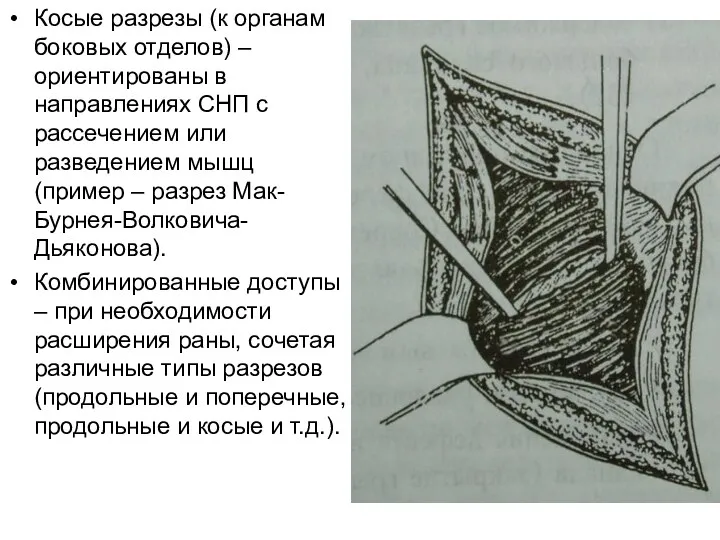 Косые разрезы (к органам боковых отделов) – ориентированы в направлениях