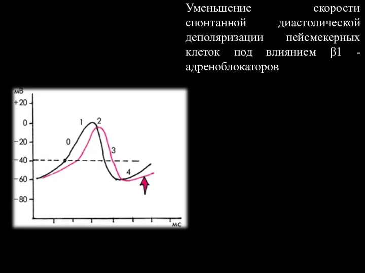 Уменьшение скорости спонтанной диастолической деполяризации пейсмекерных клеток под влиянием β1 -адреноблокаторов