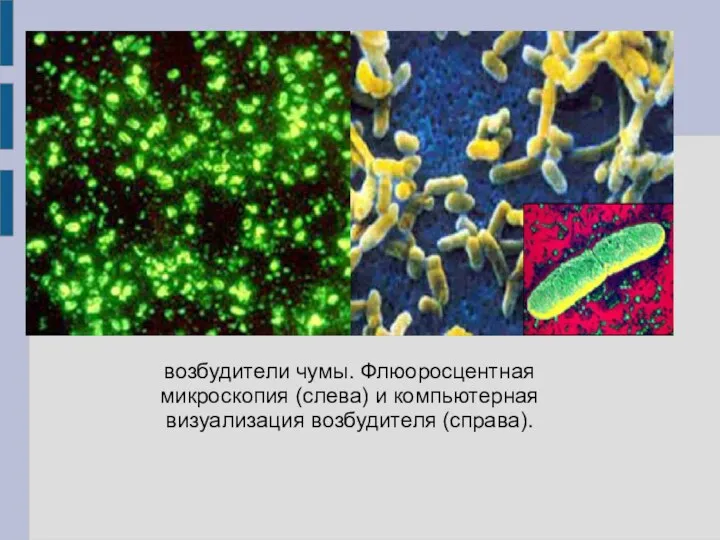 возбудители чумы. Флюоросцентная микроскопия (слева) и компьютерная визуализация возбудителя (справа).