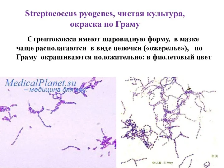 Streptococcus pyogenes, чистая культура, окраска по Граму Стрептококки имеют шаровидную