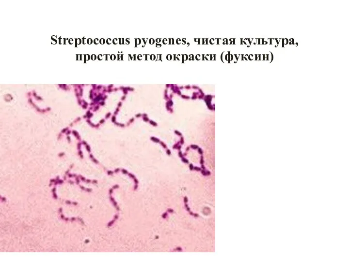 Streptococcus pyogenes, чистая культура, простой метод окраски (фуксин)