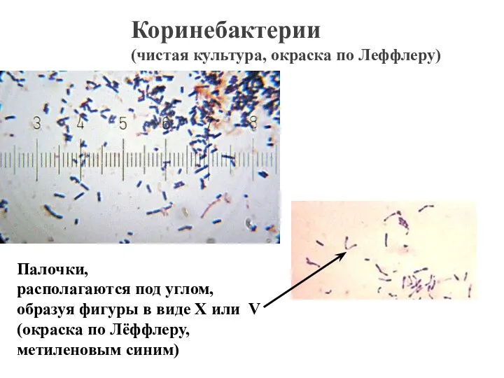 Коринебактерии (чистая культура, окраска по Леффлеру) Палочки, располагаются под углом,